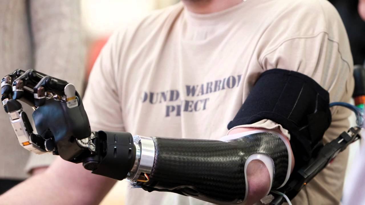 Pakistani student has developed a prosthetic arm