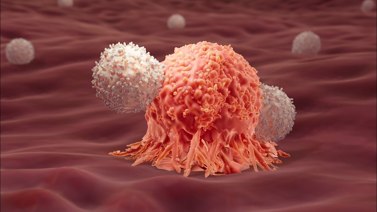 Another innovative method of cancer treatment discovered